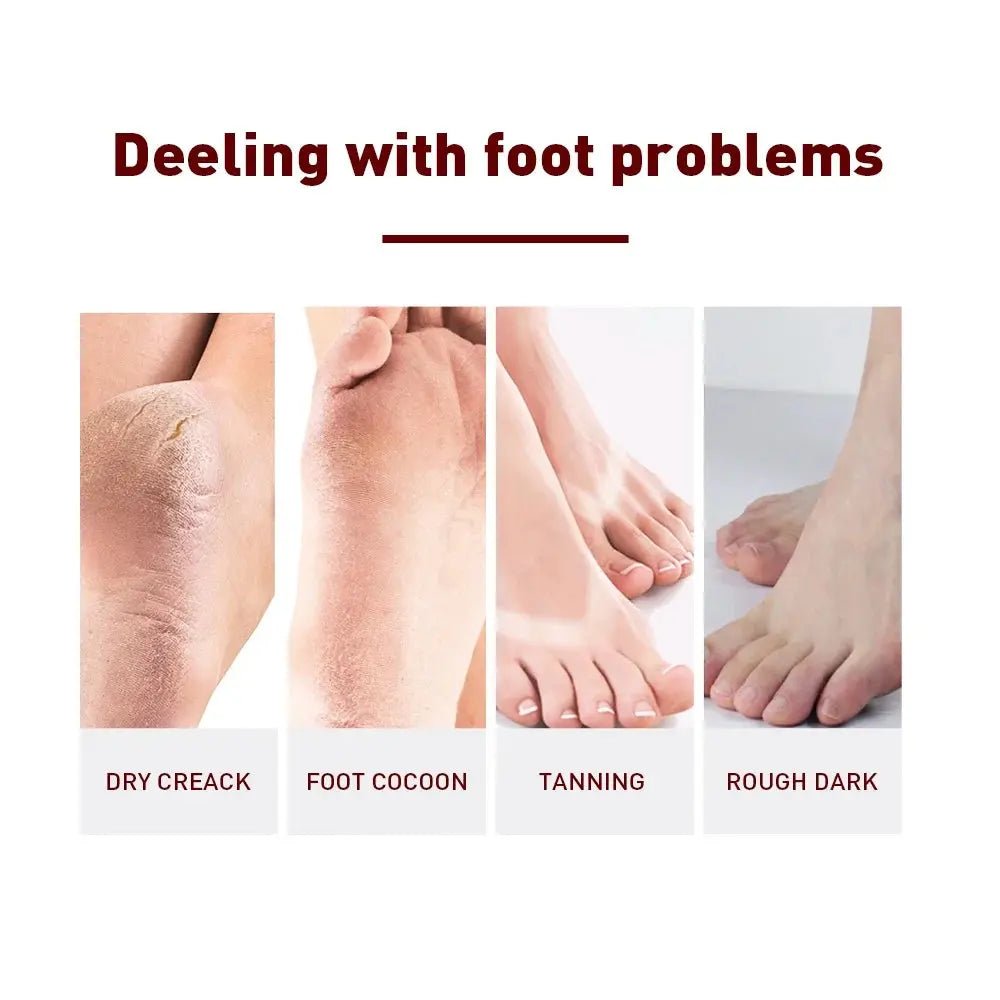 1 Pair Exfoliating Feet Mask Exfoliating Foot Peel Mask Socks PedicureTransform Your Skin with Exfoliating Feet Mask



Description:
A Series of Foot Problems,Dead Skin and Callus,Dry and Rough,Sallow and Dull

Mild Lactic Acid 、SoftenNovaCartNovacartExfoliating Feet Mask